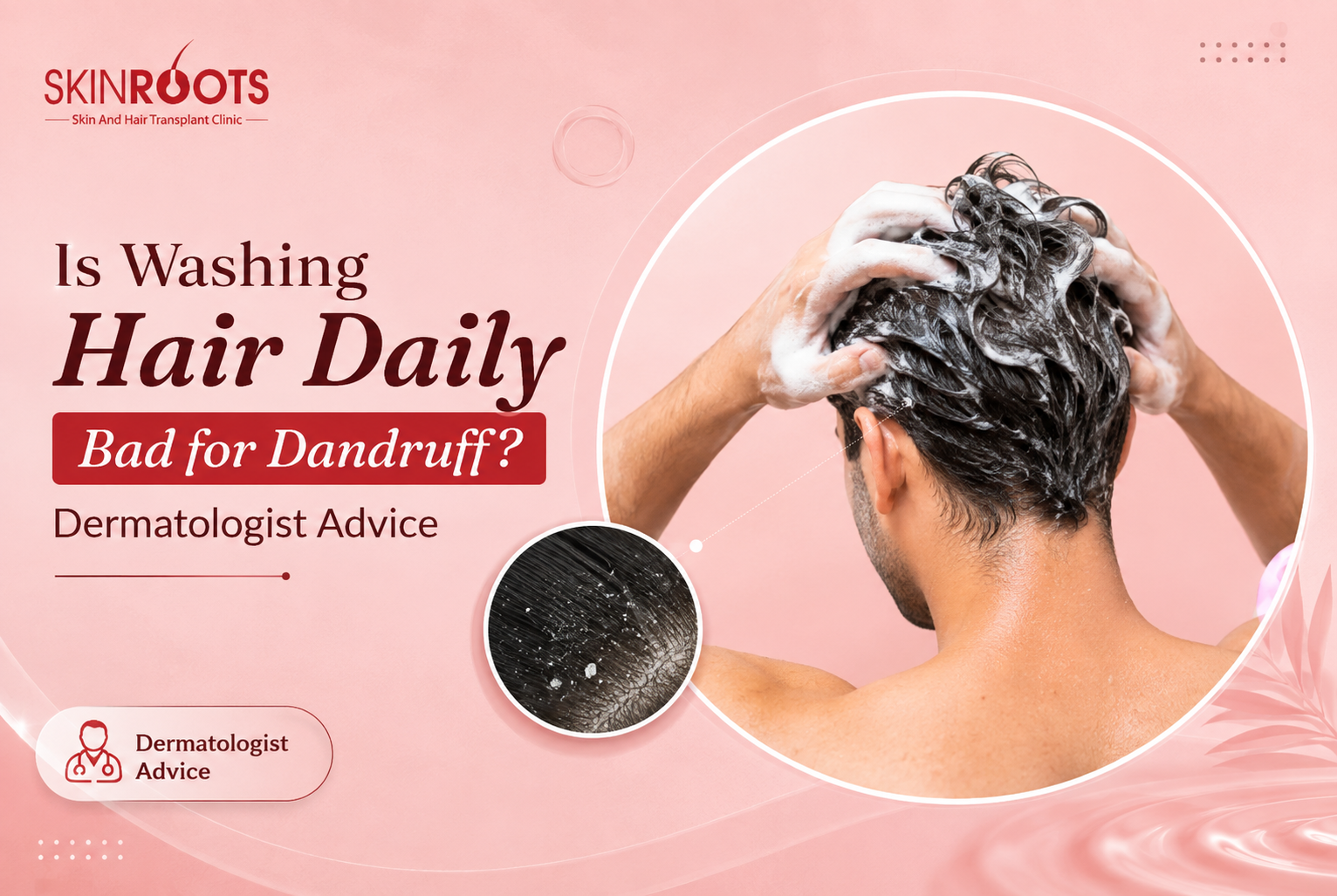 Is Washing Hair Daily Bad for Dandruff? Dermatologist Advice